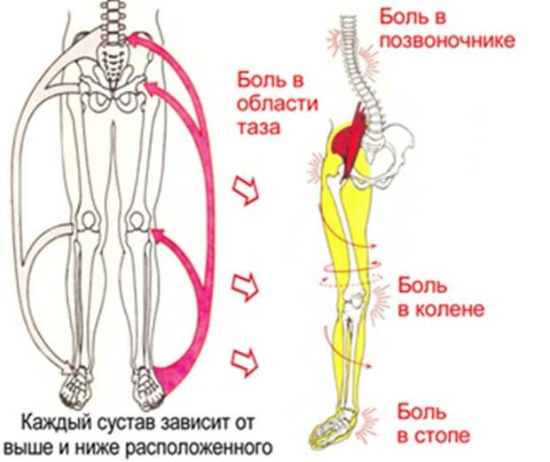 Влияние стопы на суставы. Источник изображения: Яндекс.Картинки