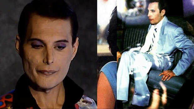 Тайна, унёсшая миллионы жизней: откуда взялся ВИЧ и почему мы до сих пор ищем ответ?