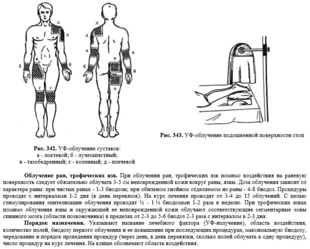 По замедленной схеме при ультрафиолетовом облучении начинают облучать