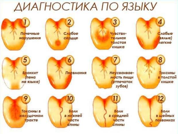 Как по языку можно узнать о сбоях в работе организма?