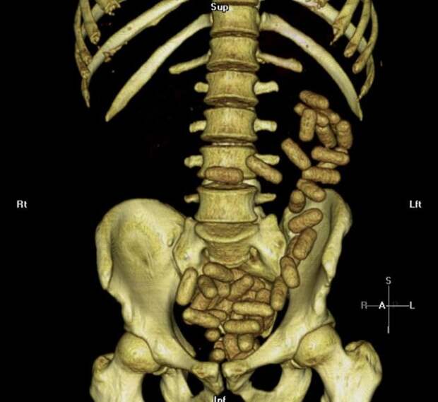 18 рентгеновских снимков, которые расскажут о вашем организме лучше, чем учебник по анатомии