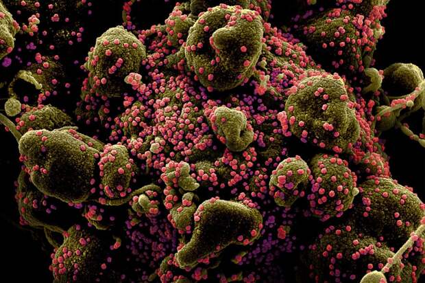 Coronavirus-Cell Coronavirus-Cell