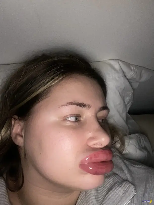 Слишком удачно качнула губья Слишком удачно качнула губья