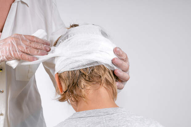 Россиянам описали порядок действий при травме из-за упавшего на голову льда