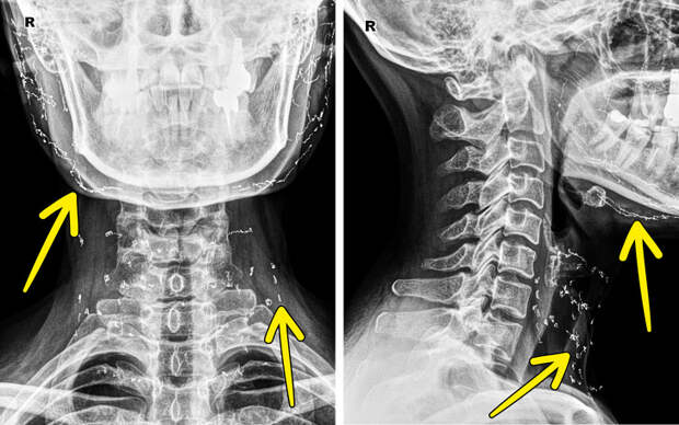 18 рентгеновских снимков, которые расскажут о вашем организме лучше, чем учебник по анатомии