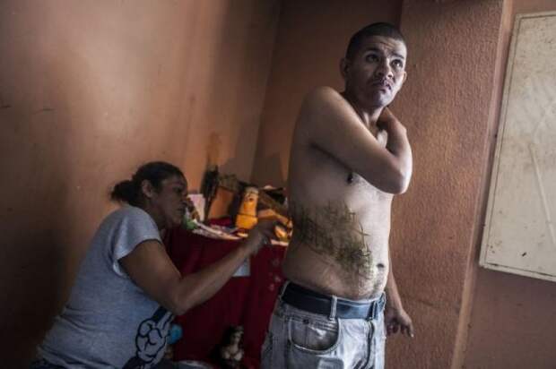 Нетрадиционные методы лечения в Венесуэле