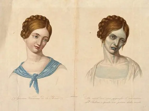 Медицинские болезни и состояния, увековеченные в произведениях искусства