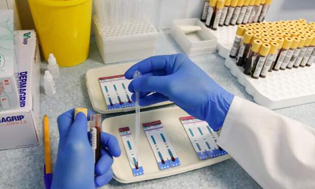 Заболеваемость ВИЧ в России сократилась вдвое за 10 лет, достигнув исторического минимума