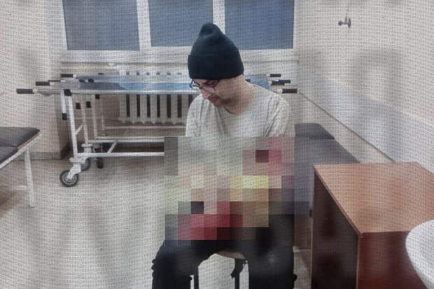 "Страна.ua": житель Одессы травмировал руку из-за опасений быть мобилизованным