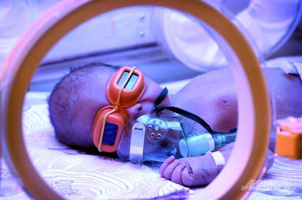 Стоимость выхаживания недоношенных малышей достигает 1,5 млн руб.