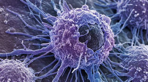 Учёные МГУ нашли способ заставить раковые клетки уничтожать себя