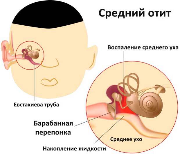 На ухе ожегся, так на 
