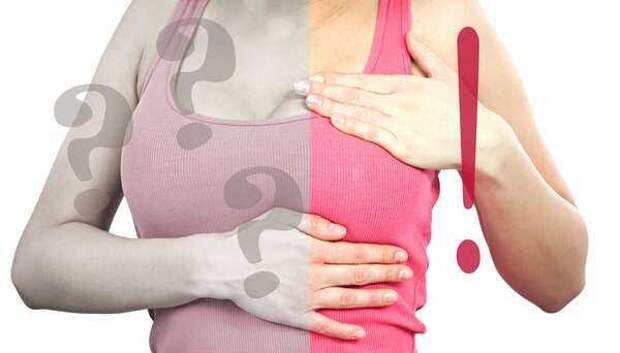 Медицинские мифы: 15 заблуждений о раке молочной железы