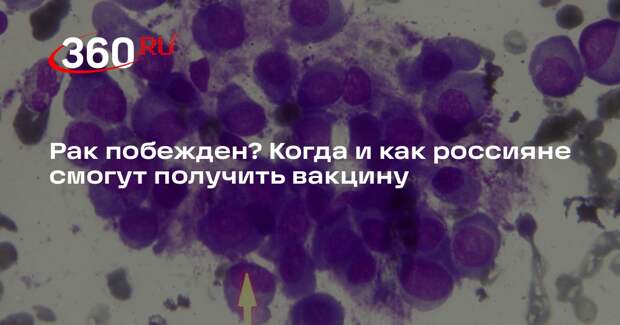 Альтштейн: первая вакцина от рака еще не прошла проверку на эффективность