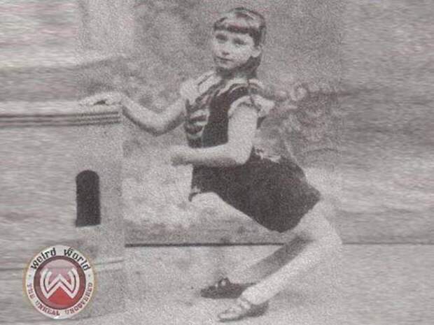 Удивительное уродство