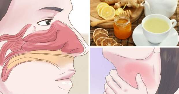 sinus