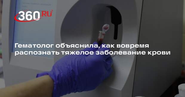 Гематолог объяснила, как вовремя распознать тяжелое заболевание крови