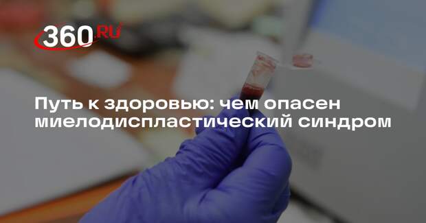 Путь к здоровью: чем опасен миелодиспластический синдром