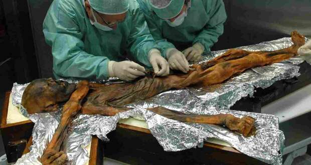 Что ученые нашли в кишечнике ледяной мумии: таинственный Эци