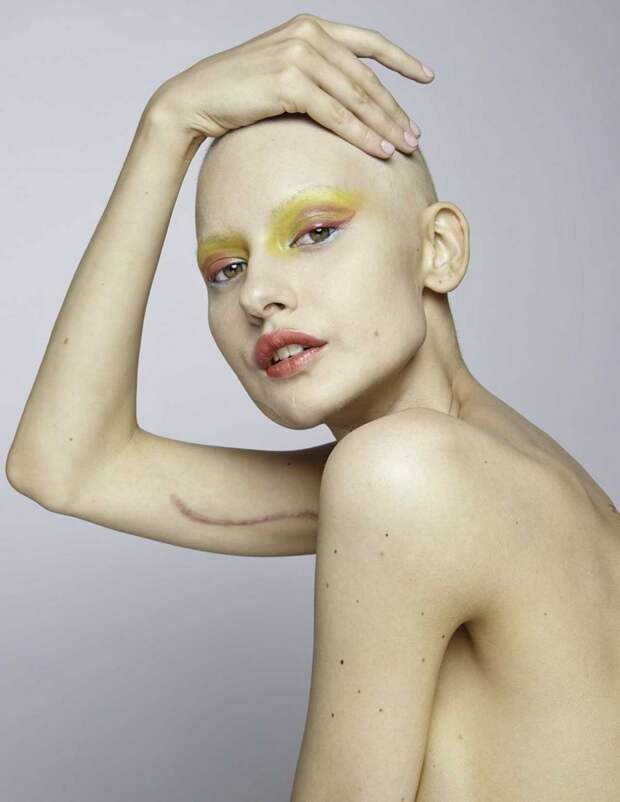 Невероятные фотографии модели, потерявшей челюсть из-за рака модель, рак