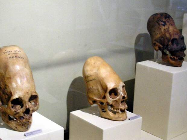 Длинный череп Перу Этот ритуал был распространен 45 000 лет назад в древних перуанских культурах. С младенческого возраста черепа детей обертывались тканью, чтобы направить рост вверх. Судя по всему, такому подвергались только дети богатых семей.