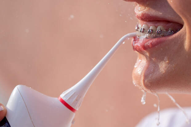 Стоматолог Тумашевич: ирригатор помогает избавиться от зубного камня