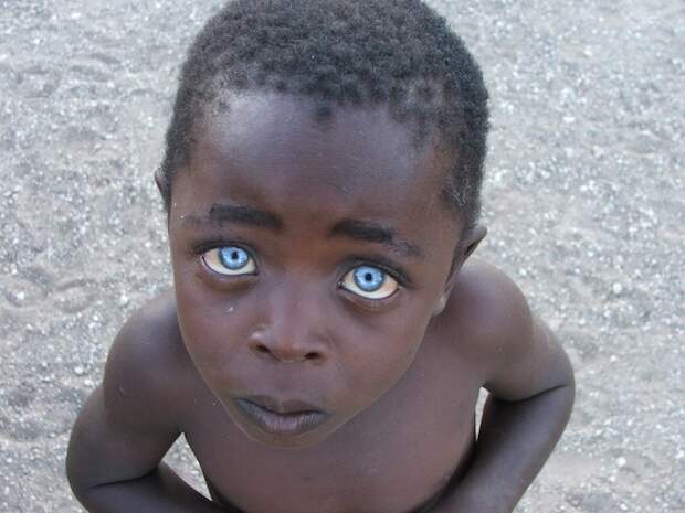 Поразительно красивые глаза реальных людей  глаза, люди
