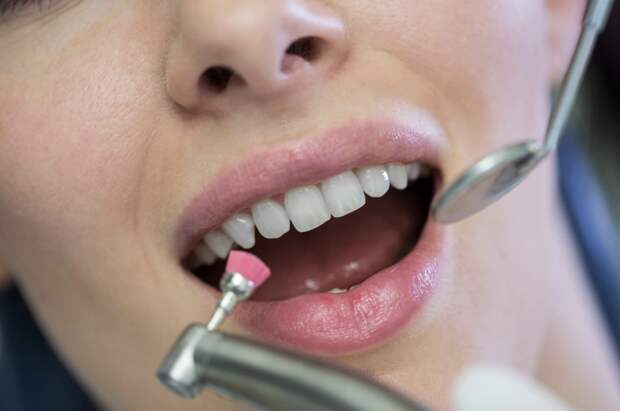 Стоматолог Лысенков раскрыл причины появления темных пятен на зубах