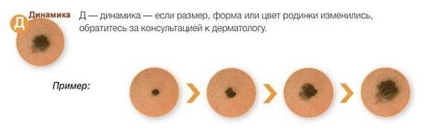 original (1)