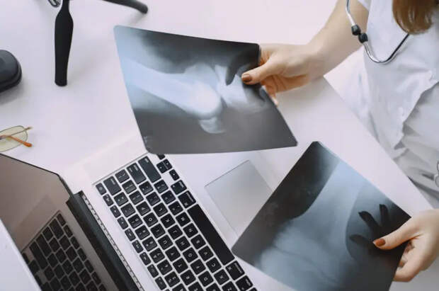 В "Склифе" показали на рентгене самые неожиданные находки в телах пациентов