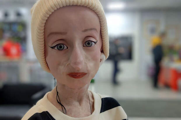 Больная прогерией Аня Добби назвала своей главной мечтой поездку в Дубай