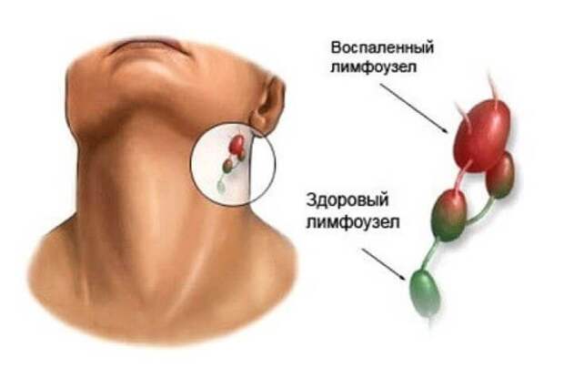 Всё о лимфатической системе