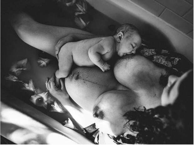 25 жестоких, но честных фото о том, во что роды превращают женское тело