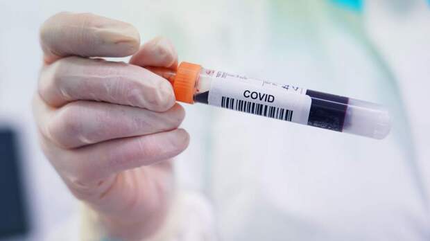 Семь случаев заражения новым штаммом коронавируса ХЕС зарегистрировали в РФ