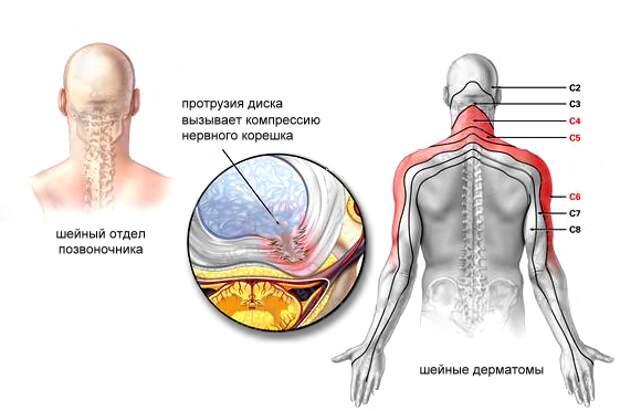 Почему немеют руки