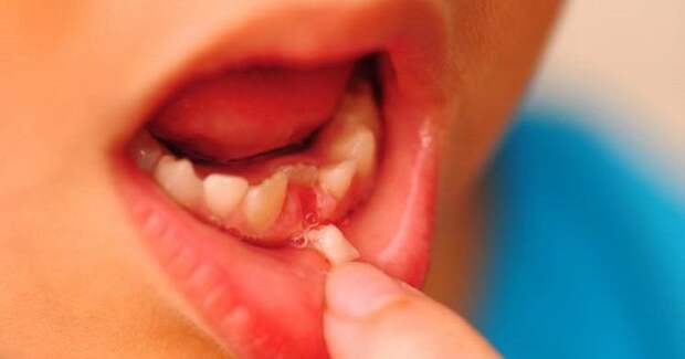 Вот почему не нужно отдавать молочные зубы зубной фее. Поразительное открытие!