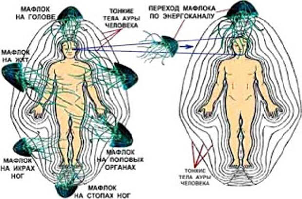 Расположение прицеплений мафлока
