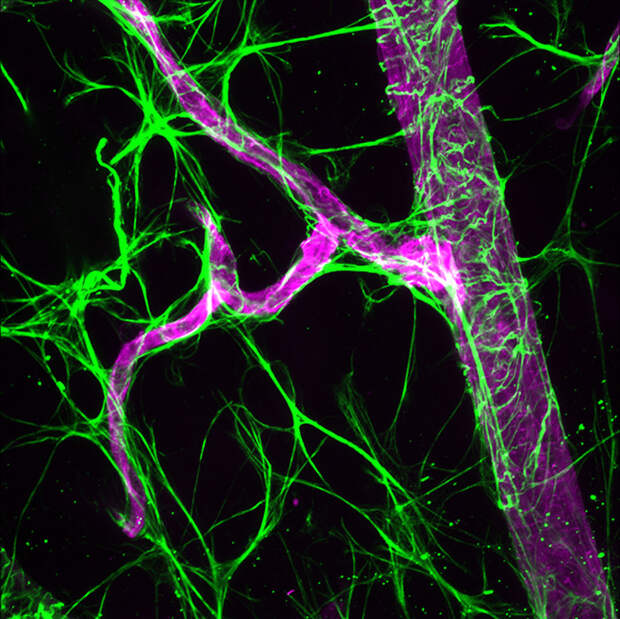 Мышь. Астроциты (зелёные) и кровеносные сосуды (фиолетовые) макро, микро, микросъемка, микросъёмка