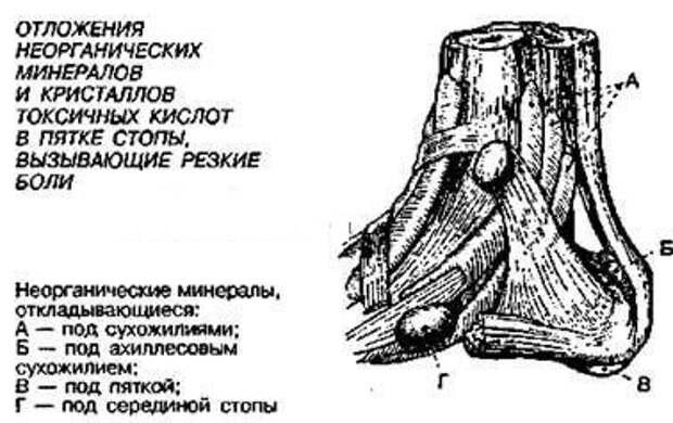 Шпоры и образования в суставах: Тест Брэгга на заизвесткованность Шпоры и образования в суставах: Тест Брэгга на заизвесткованность
