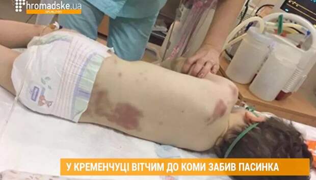 Как распознать мошенничество при сборе средств на лечение детей?