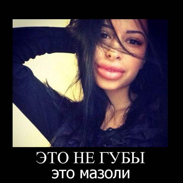 Губастики и их трудовые мазоли