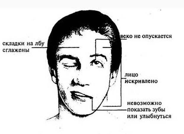 Инсульт: Это удивительный и нетрадиционный способ спасения от инсульта! Инсульт: Это удивительный и нетрадиционный способ спасения от инсульта!