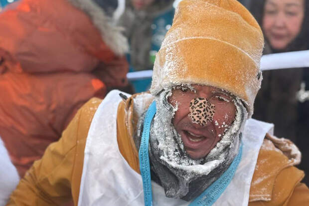 Экс-футболист Смертин отморозил палец на ноге во время марафона в Оймяконе