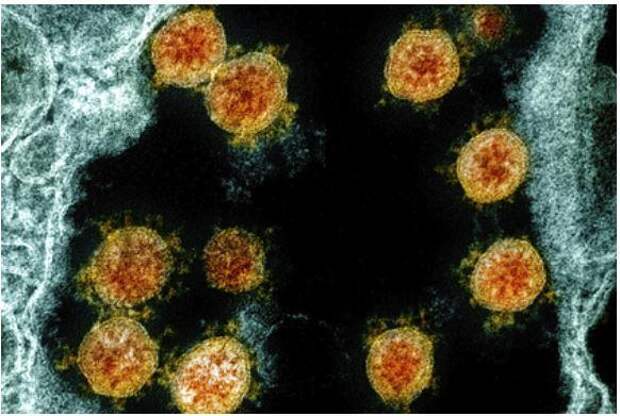 Определена новая смертельная опасность коронавируса