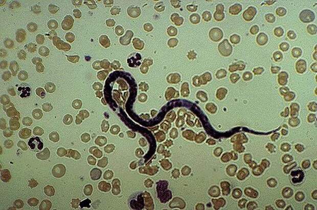 Дирофилярия и личинки. Фото из интернета.