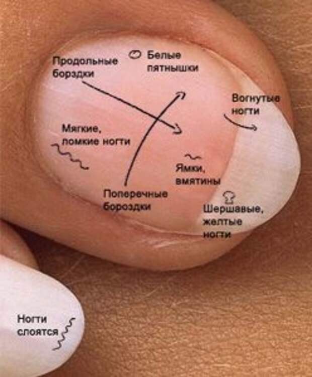 Значение отметок на ногтях