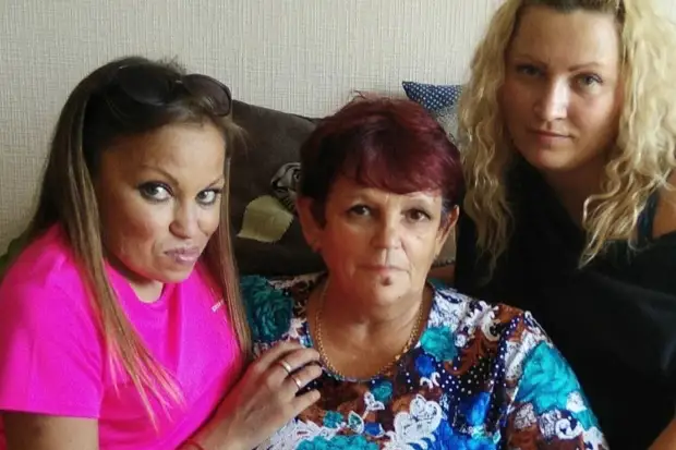 Всегда грустная: как выглядит девушка, которая ни разу в жизни не улыбалась, — она стала моделью, несмотря на редкую болезнь