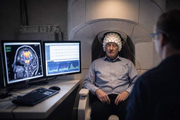 Учёные научились предсказывать Альцгеймер за 2,5 года до симптомов