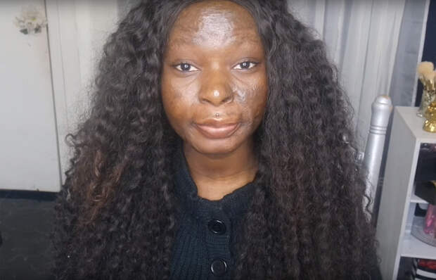 burn-victim-power-of-make-up-transformation-shalom-nchom-blac-7