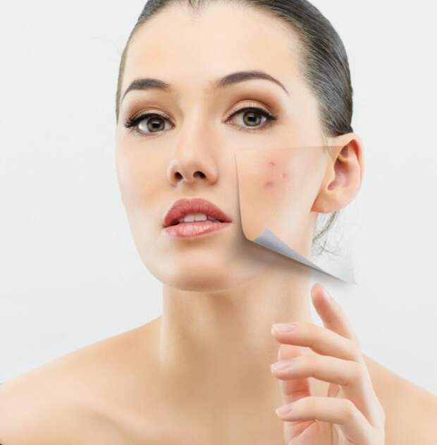Плохие привычки или неправильный уход плохо влияют на состояние твоей кожи.